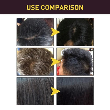 Champú Oscurecedor Natural de Cabello – Black Hair Dye (500 ml)